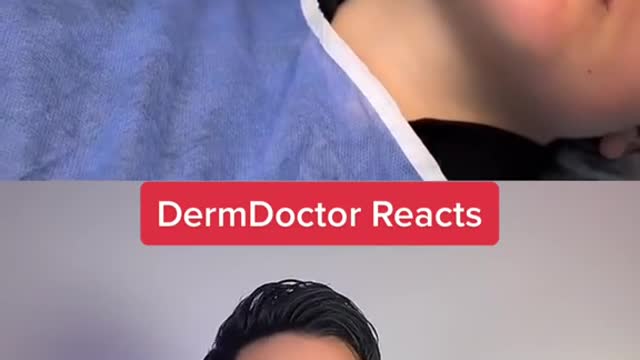 but .... but.. the glove touched the cyst.. before she put in the mouth