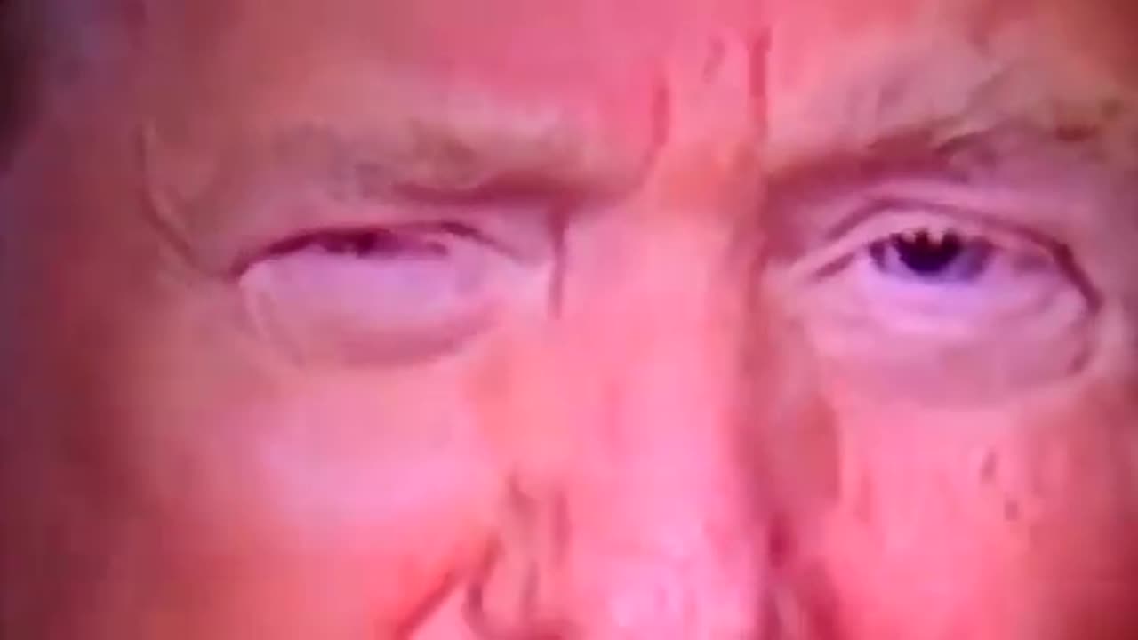 Donald Trump's Eye Anomaly