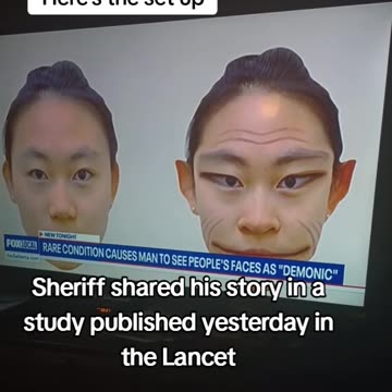 Gee, telling the truth but claiming it's a mental disorder??