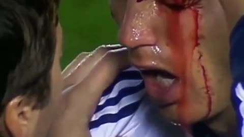 Ronaldo is in a lot of pain, is in a lot of pain is serious