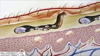 Infectious Disease - Section 2 - MedQuest