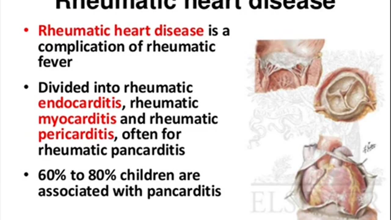 Rheumatic Health Natural Solutions