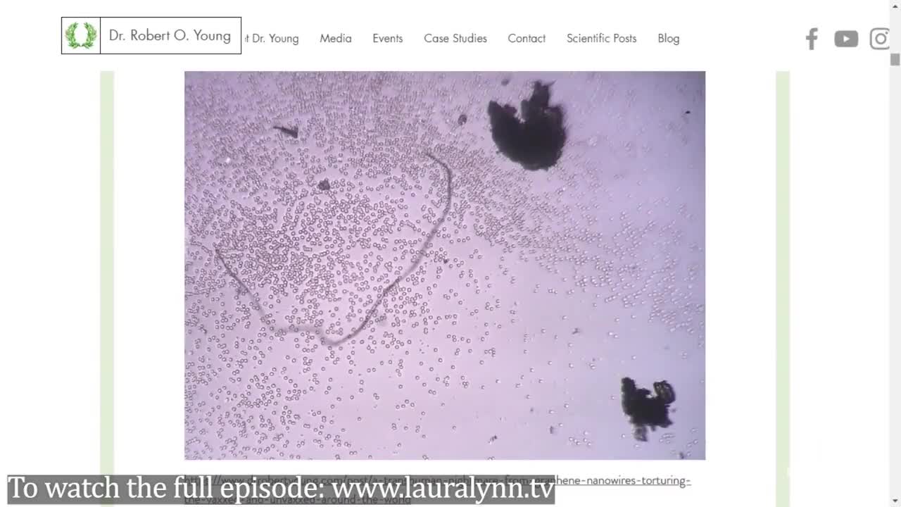 Coágulos Repteis dentro do IFA das Vaxxinas?