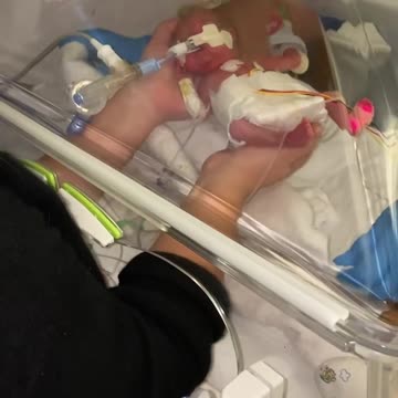 Look at how this precious preemie fits perfectly in her mother's hands! 🥺 💗