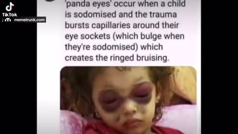 Military Operations clearing out DUMBS and Saving our children