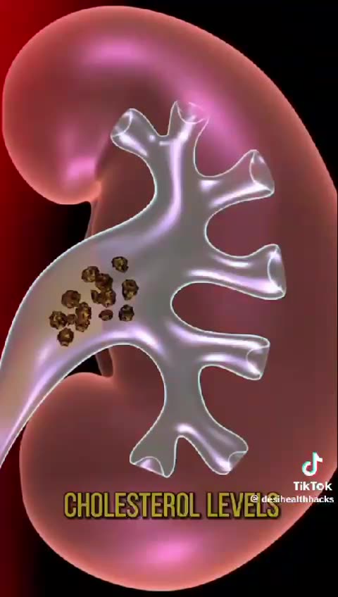 Indian remedy of and prevention from having kidney stones...