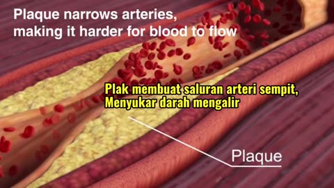 Fish Oil and cholesterol