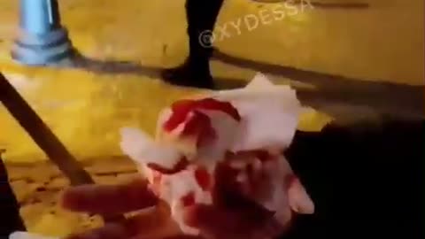 ATAQUE ZOMBI EN UCRANIA.