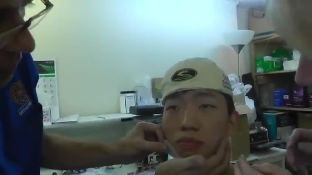 Preparation of Adult Orthotropics Headgear (Modified RAMPA System) by Dr Mike Mew Part 2