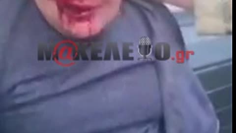 Τάγμα ΑΖΟΦ: Φρίκη στο αίμα ζωντανών νεκρών - 2