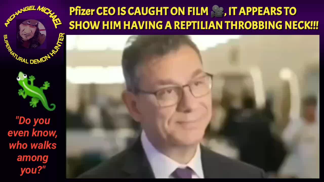 EXCLUSIVE Pfizer CEO throbbing neck