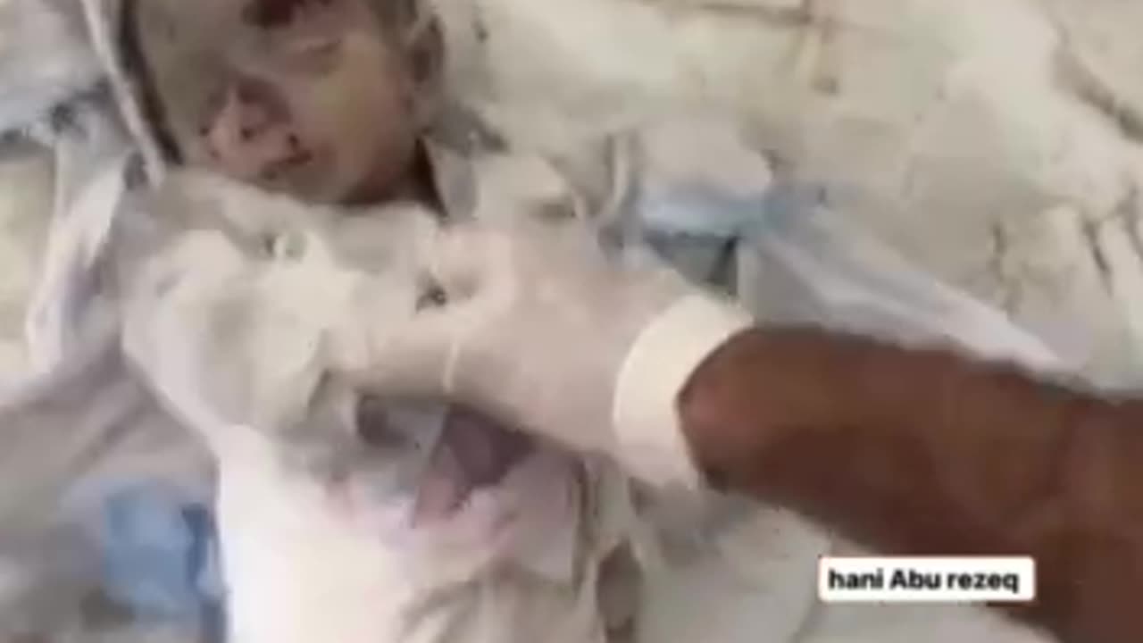 The effects of the occupation bombing of Gaza and the death of dozens of children