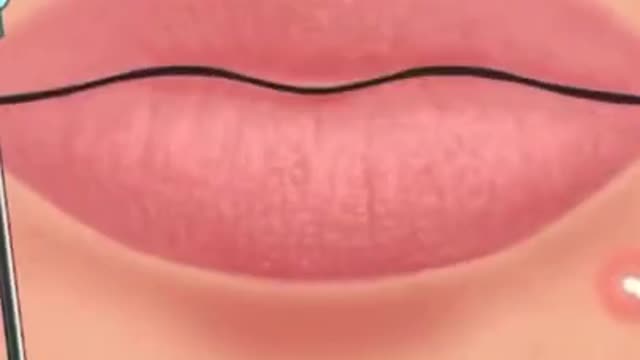 [ASMR] Acne Blackhead Removal Process Skincare Animation