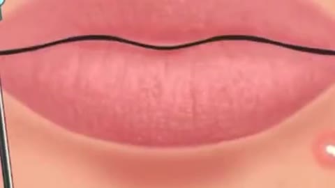 [ASMR] Acne Blackhead Removal Process Skincare Animation