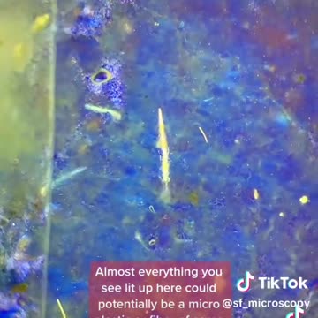 What can we find in a McNugget under the microscope?