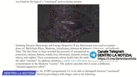 Grafene nei vaccini covid 19 ; è una sostanza molto tossica per tutti gli esseri viventi