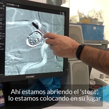 En Bucaramanga y por primer vez en Latinoamérica se emplea técnica para tratar aneurismas cerebrales