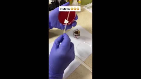 NUTELLA - FULL OF PARASITES