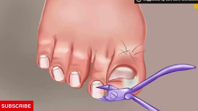 foot nail treatment arms animation