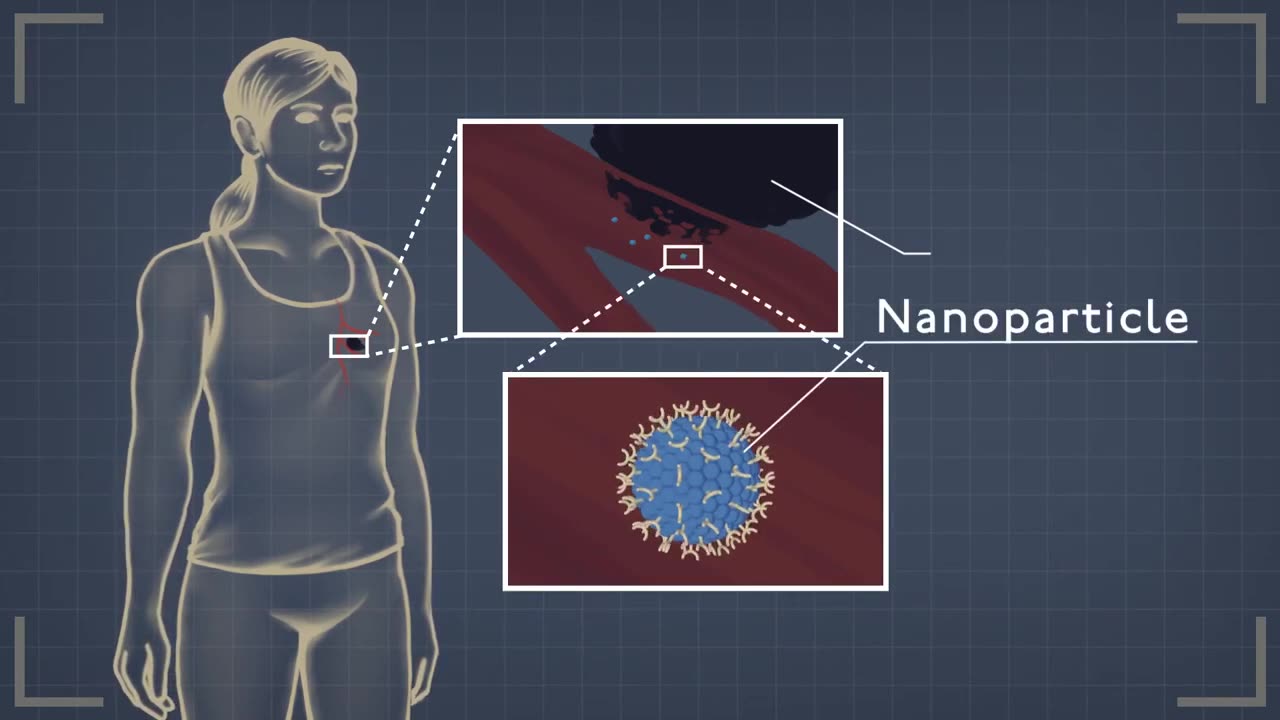 Nanomedicine Intra-Body