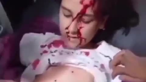 A 20 years young protesting girl shot on chest and face by Iran dictators