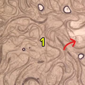 See how parasites in the human body react to onions and garlic!