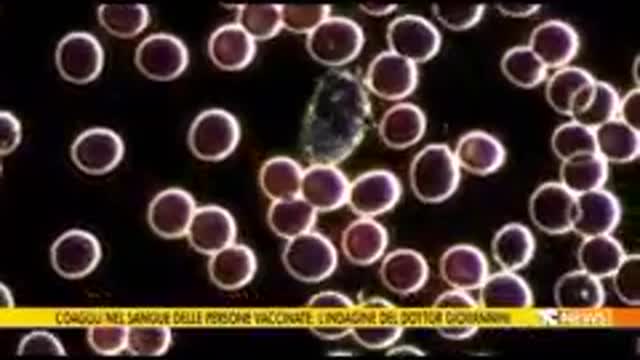 Le analisi del Dr. Giovannini nel sangue dei vaccinati