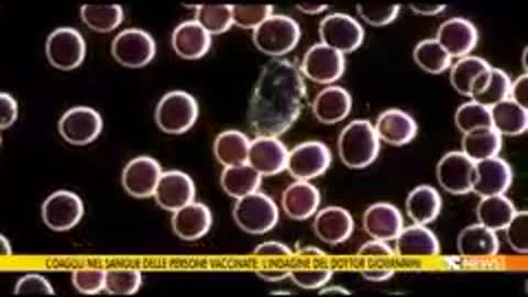 Le analisi del Dr. Giovannini nel sangue dei vaccinati