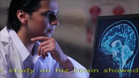 Albert Einstein Brain.