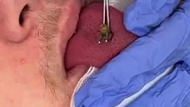 This came out of his tongue...