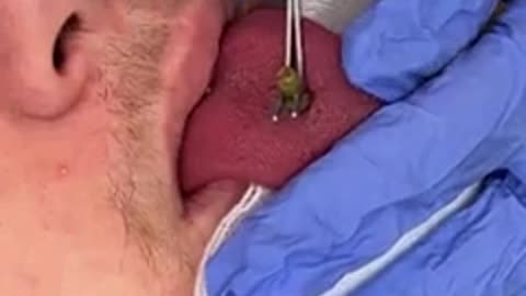 This came out of his tongue...