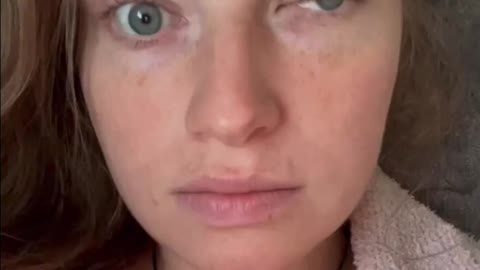 Vax injuries
