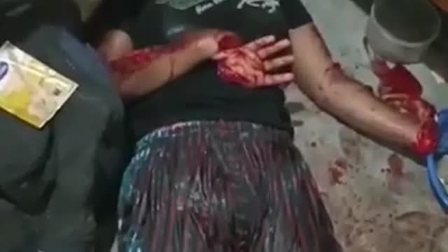 Accident
