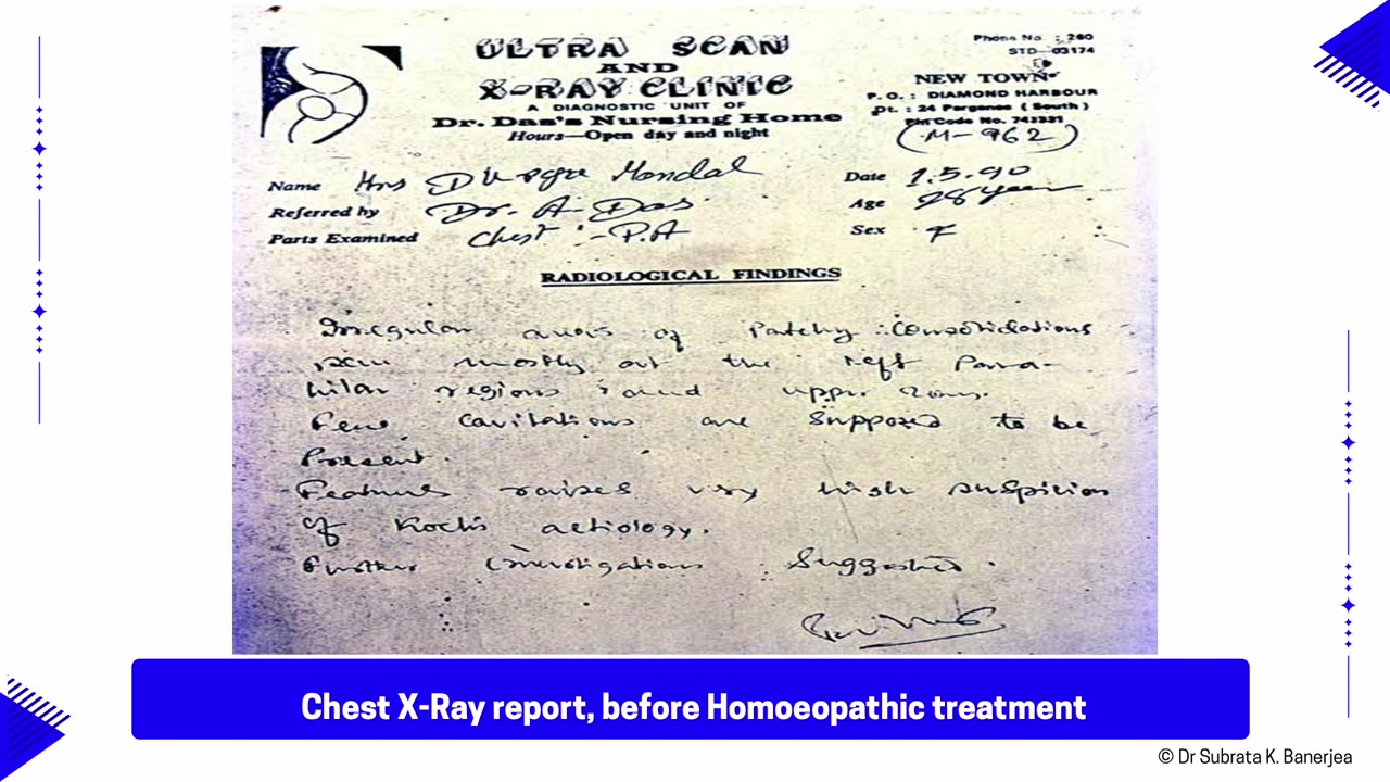 ACH - CASE PPT - RE006-PULMONARY KOCH_S WITH BRONCHOSPASM-DM