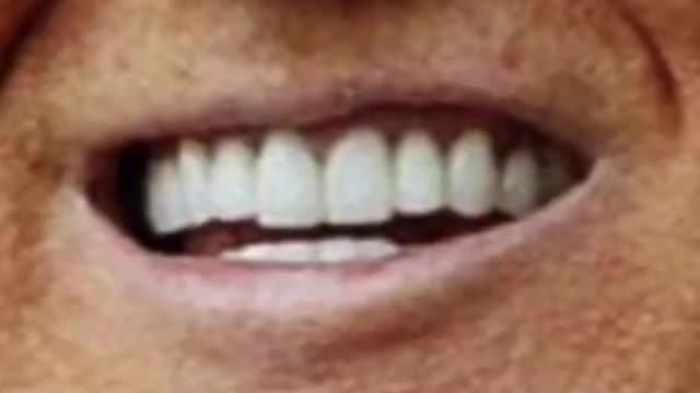 CLEAN THE TEETH BY A SMART PRODUCT ACCORDING TO LEGENT DOCTOR