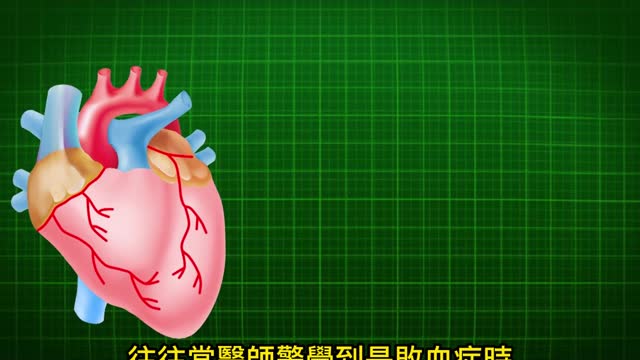 敗血症奪命? 最新診斷準則、治療趨勢
