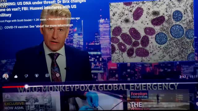 Monkey Pox - New Pamdemic Like AIDS