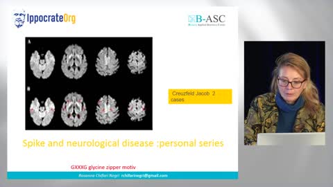 ICS 2022 (France) - R.Chifari -"The neurological effects of spike"