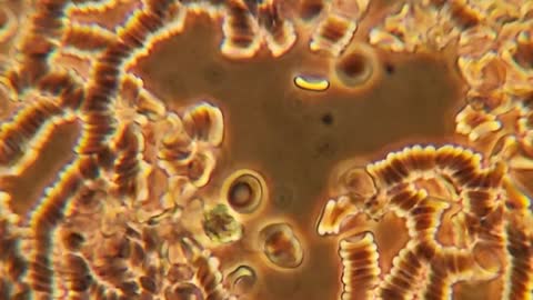 20220305_[펌] [위험한 현미경] 3차 접종자의 혈액 현미경 일기(2022.03.04)