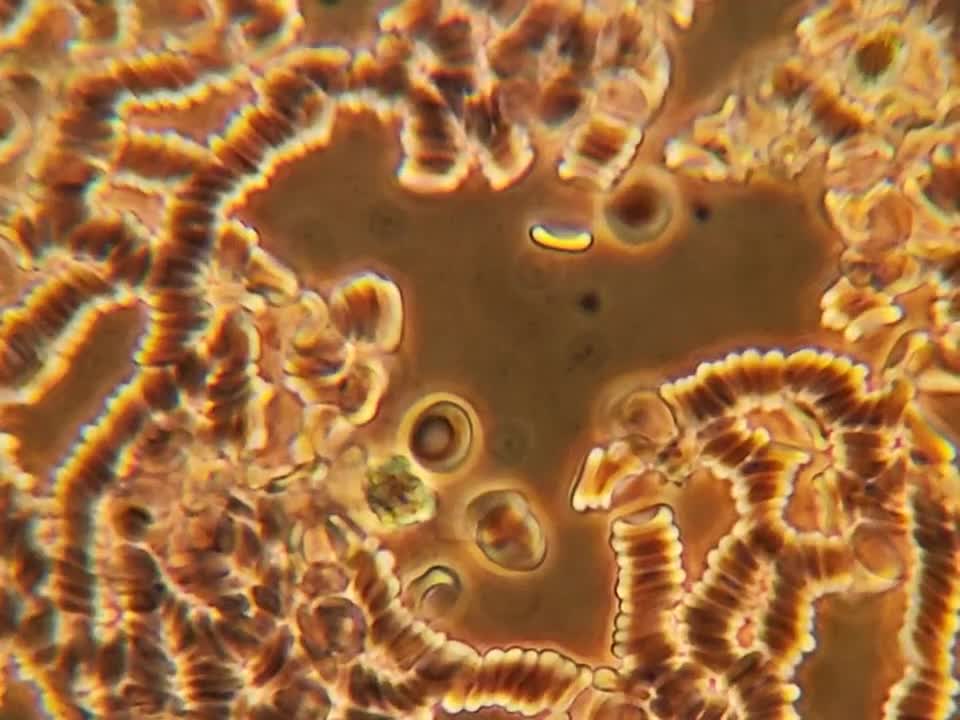 20220305_[펌] [위험한 현미경] 3차 접종자의 혈액 현미경 일기(2022.03.04)