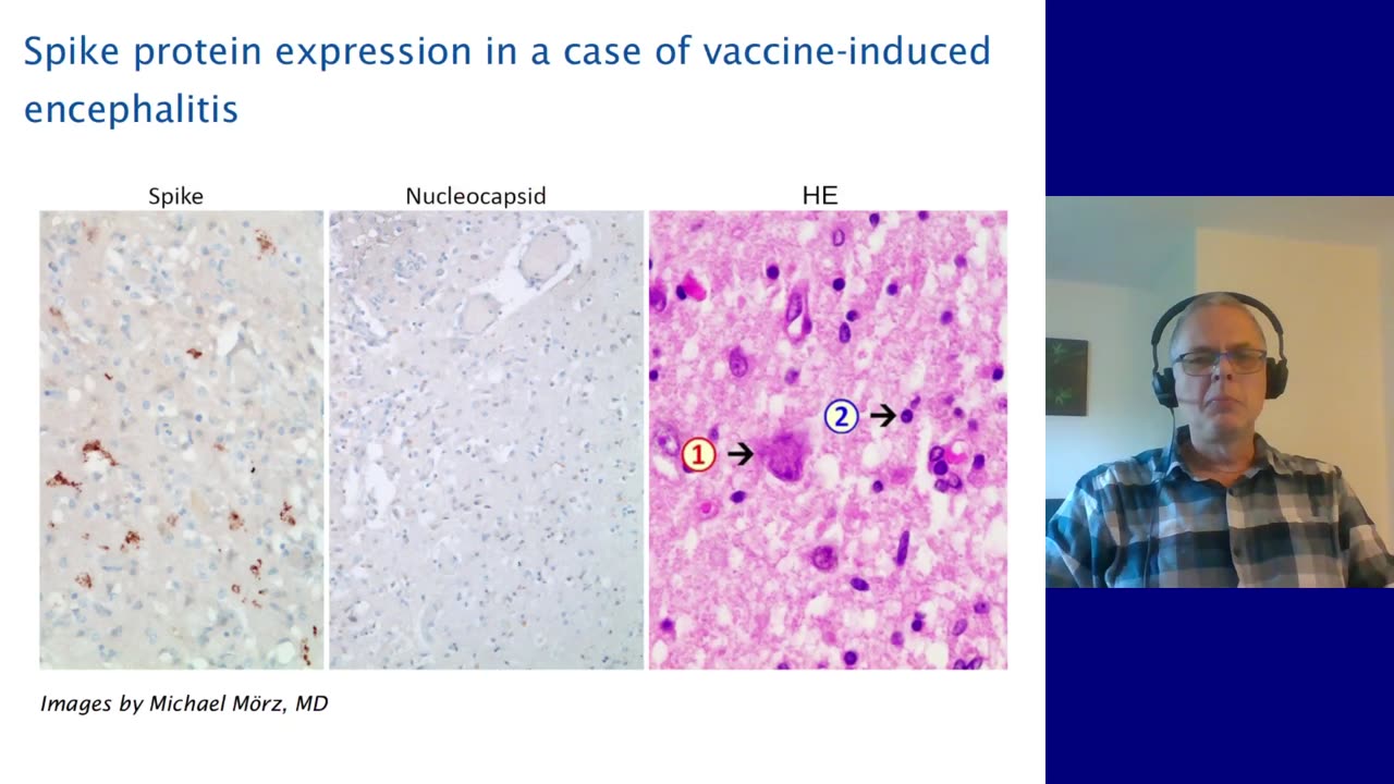 Alternate mechanisms of mRNA vaccine toxicity: which one is the main culprit?