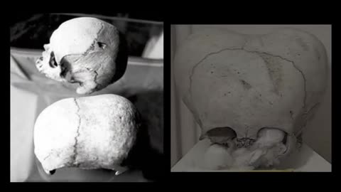 The Missing Alien Bodies of Malta | A Cover Up?