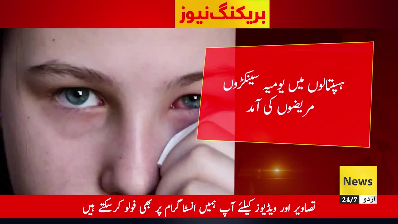 Breaking news Eyes infection case in karachi