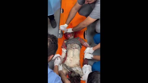 Brutality of israel's indiscriminate bombing in Gaza - a boy in his last moments *NSFW