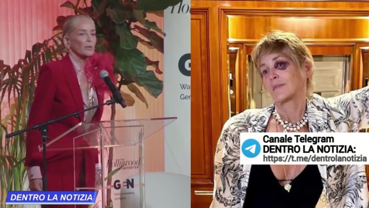 Anche Sharon Stone fa parte del “club Black Eye” e spiega come si è fatta l'occhio nero!