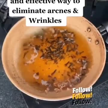 Say Bye Bye To Acne And Wrinkles
