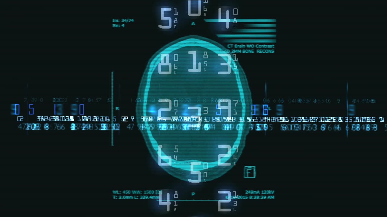 Douglas Lima - CT Scan