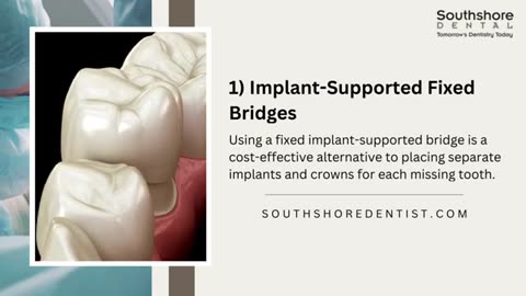 Your Guide to Smile Restoration: Exploring Types of Tooth Implant