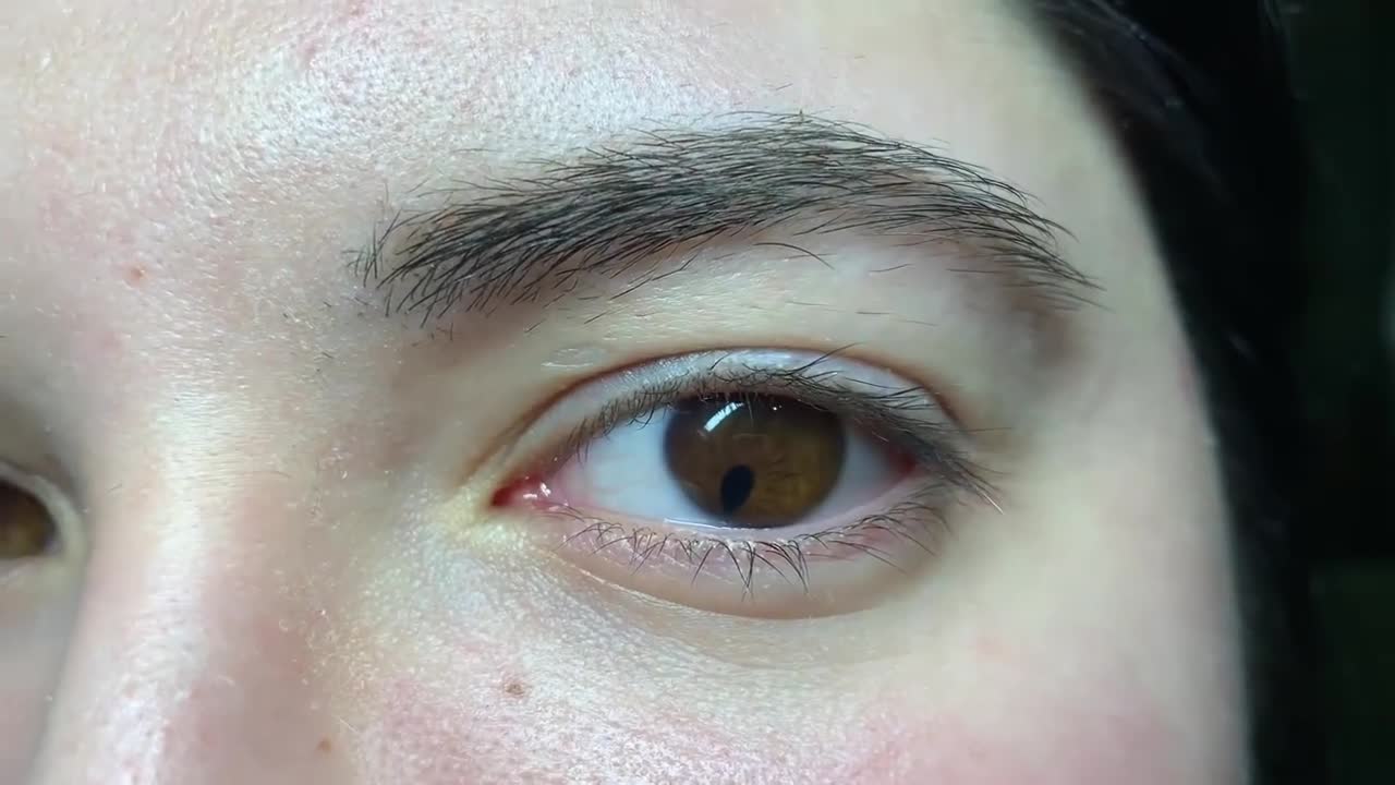 A Really Small Pupil