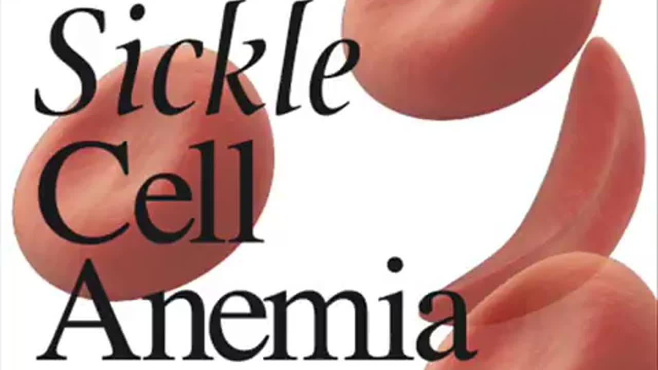 Understanding The Origin And Solution For Sickle Cell! 317-709-8045